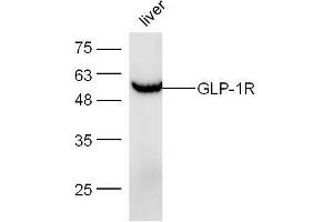 Mouse liver lysates probed with Anti-GLP-1R Polyclonal Antibody, Unconjugated  at 1:5000 for 90 min at 37˚C. (GLP1R Antikörper  (AA 101-200))
