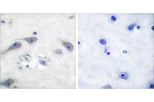 Peptide - +Immunohistochemical analysis of paraffin-embedded human brain tissue using DARPP-32 (Ab-75) antibody (#B0007).