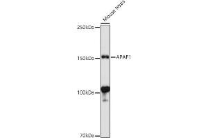 Western blot analysis of extracts of Mouse testis, using  antibody (ABIN1678685, ABIN3015308, ABIN3015309 and ABIN6213977) at 1:1000 dilution.