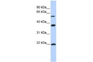 WB Suggested Anti-MYLIP Antibody Titration:  0. (MYLIP Antikörper  (Middle Region))