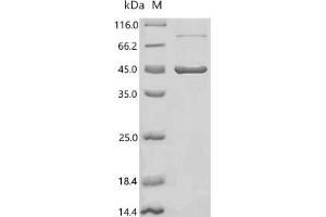 (Tris-Glycine gel) Discontinuous SDS-PAGE (reduced) with 5 % enrichment gel and 15 % separation gel.