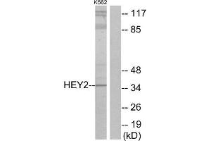 Western Blotting (WB) image for anti-Hairy/enhancer-of-Split Related with YRPW Motif 2 (HEY2) (Internal Region) antibody (ABIN1850038) (HEY2 Antikörper  (Internal Region))