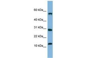 Image no. 1 for anti-Signal Recognition Particle 19kDa (SRP19) (C-Term) antibody (ABIN6741676) (SRP19 Antikörper  (C-Term))