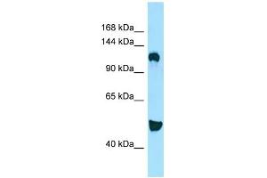WB Suggested Anti-DGKD Antibody Titration: 1. (DGKD Antikörper  (C-Term))