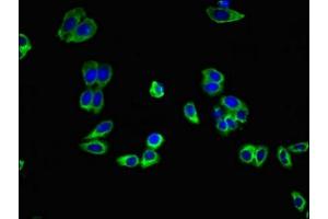 Immunofluorescent analysis of HepG2 cells using ABIN7143426 at dilution of 1:100 and Alexa Fluor 488-congugated AffiniPure Goat Anti-Rabbit IgG(H+L) (Adiponectin Receptor 1 Antikörper  (AA 1-63))