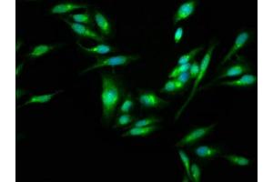 Immunofluorescence staining of Hela cells with ABIN7170595 at 1:100, counter-stained with DAPI. (SKA3 Antikörper  (AA 101-195))