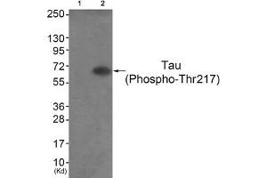 Western blot analysis of extracts from HepG2 cells (Lane 2), using Tau (Phospho-Thr217) Antibody. (MAPT Antikörper  (pThr217))