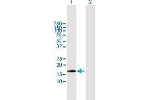 Western Blot analysis of EDN2 expression in transfected 293T cell line by EDN2 MaxPab polyclonal antibody. (Endothelin 2 Antikörper  (AA 1-178))