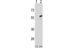 Western blot analysis of CDC20 antibody and 293 cell lysate either nontransfected (Lane 1) or transiently transfected (2) with the CDC20 gene.