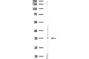 anti-StAR-Related Lipid Transfer (START) Domain Containing 10 (STARD10) (Internal Region) antibody