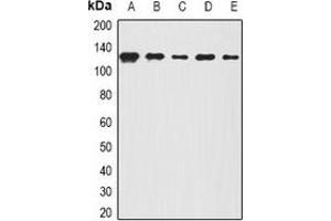 Western blot analysis of BOC expression in A431 (A), Hela (B), mouse lung (C), mouse brain (D), rat spinal cord (E) whole cell lysates. (BOC Antikörper)