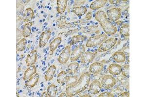 Immunohistochemistry of paraffin-embedded Mouse kidney using GLA Polyclonal Antibody at dilution of 1:100 (40x lens). (GLA Antikörper)