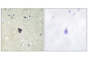 Immunohistochemistry (IHC) image for anti-Colony Stimulating Factor 1 Receptor (CSF1R) (Tyr809) antibody (ABIN1848010) (CSF1R Antikörper  (Tyr809))