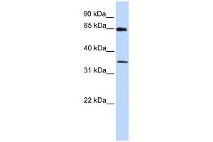 GTF2B antibody used at 0.