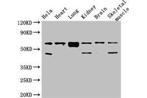 Western Blot Positive WB detected in: Hela whole cell lysate, Mouse heart tissue, Mouse lung tissue, Mouse kidney tissue, Mouse brain tissue, Mouse skeletal muscle tissue All lanes: PRKAA2 antibody at 2. (PRKAA2 Antikörper  (Catalytic Subunit alpha))