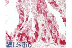 ABIN5539873 (5µg/ml) staining of paraffin embedded Human Prostate. (NELL2 Antikörper  (Internal Region))