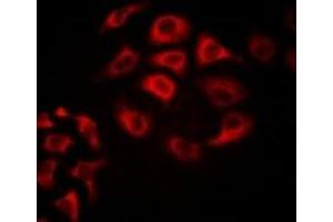 Immunofluorescent analysis of Tetranectin staining in Hela cells.