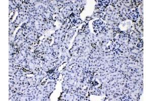 IHC testing of mouse kidney tissue with hnRNP A1 antibody at 1ug/ml.