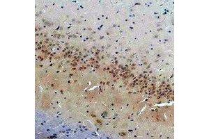 Immunohistochemical analysis of CACNG2 staining in rat brain formalin fixed paraffin embedded tissue section. (Stargazin Antikörper)