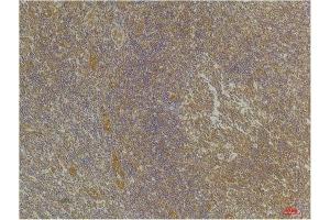 Immunohistochemistry (IHC) analysis of paraffin-embedded Human Tonsil Tissue using CXCR4 Rabbit Polyclonal Antibody diluted at 1:200. (CXCR4 Antikörper)