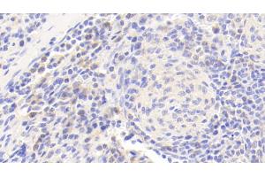 Detection of JNK1 in Human Spleen Tissue using Polyclonal Antibody to c-Jun N-terminal Kinase 1 (JNK1) (C-Jun N-Terminal Kinases (AA 145-419) Antikörper)