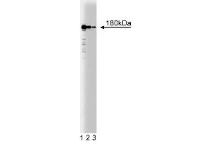 Western blot analysis of Clathrin Heavy Chain on HeLa cell lysate (center). (Clathrin Antikörper  (AA 4-171))