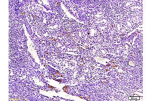 Formalin-fixed and paraffin embedded mouse endometrium tissue labeled with Anti-ECM1 Polyclonal Antibody, Unconjugated (ABIN673071) at 1:300, followed by conjugation to the secondary antibody and DAB staining (ECM1 Antikörper  (AA 488-567))