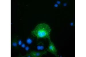 Anti-FAM84B mouse monoclonal antibody (ABIN2453036) immunofluorescent staining of COS7 cells transiently transfected by pCMV6-ENTRY FAM84B (RC207996). (FAM84B Antikörper)