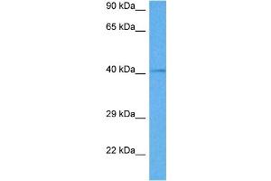 Host:  Rabbit  Target Name:  GATA5  Sample Tissue:  Mouse Testis  Antibody Dilution:  1ug/ml (GATA5 Antikörper  (C-Term))