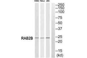 Western blot analysis of extracts from K562 cells, HeLa cells and 293 cells, using RAB2B antibody.