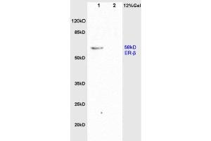 L1 rat brain, L2 rat colon lysates probed  at 1:200 in 4˚C. (Estrogen Receptor alpha + beta (AA 201-300) Antikörper)