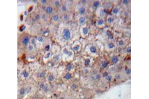Used in DAB staining on fromalin fixed paraffin-embedded Liver tissue (GP1BB Antikörper  (AA 53-176))