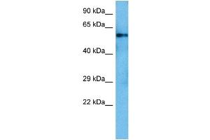 Host:  Rat  Target Name:  SMAD5  Sample Tissue:  Rat Liver  Antibody Dilution:  1ug/ml (SMAD5 Antikörper  (Middle Region))