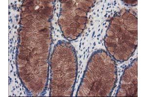 Immunohistochemical staining of paraffin-embedded Human colon tissue using anti-KATNB1 mouse monoclonal antibody. (KATNB1 Antikörper)