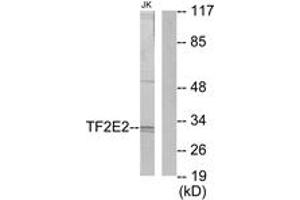 Western blot analysis of extracts from Jurkat cells, using TF2E2 Antibody. (GTF2E2 Antikörper  (AA 151-200))