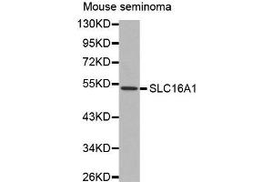 Western Blotting (WB) image for anti-Solute Carrier Family 16, Member 1 (Monocarboxylic Acid Transporter 1) (SLC16A1) antibody (ABIN3017184) (SLC16A1 Antikörper)