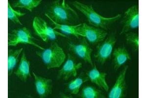 Immunfluorescence staining of the human glioma cell line U251. (Nestin Antikörper)