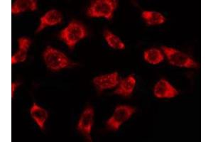 ABIN6278608 staining MCF7 by IF/ICC.