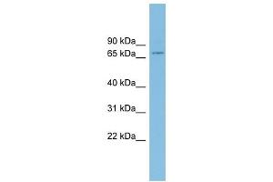 EIF4B antibody used at 1 ug/ml to detect target protein. (EIF4B Antikörper  (Middle Region))