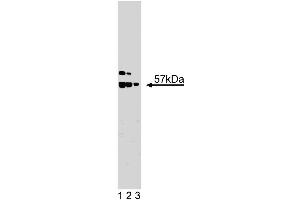 Western blot analysis of hILP/XIAP on Jurkat lysate. (XIAP Antikörper  (AA 268-426))