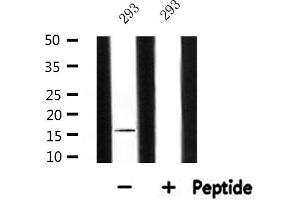 Western blot analysis of extracts from 293, using MRPL14 Antibody. (MRPL14 Antikörper  (C-Term))