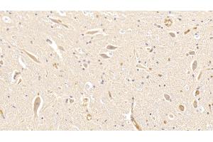 Immunohistochemistry (IHC) image for anti-Hemoglobin antibody (ABIN7437236)