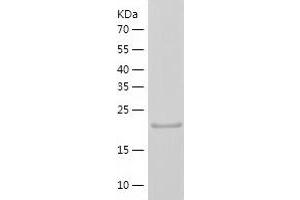 Western Blotting (WB) image for Protein tyrosine Phosphatase, Receptor Type, C (PTPRC) (AA 1031-1251) protein (His tag) (ABIN7124684) (CD45 Protein (AA 1031-1251) (His tag))