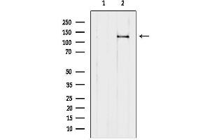 anti-phospholipase C, beta 1 (phosphoinositide-Specific) (PLCB1) (Internal Region) antibody