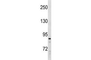 SUZ12 antibody western blot analysis in Ramos lysate. (SUZ12 Antikörper  (AA 559-588))