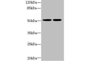 Western blot All lanes: MATK antibody at 5. (MATK Antikörper  (AA 393-507))