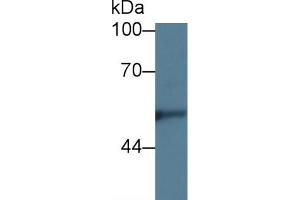 Western blot analysis of Human Hela cell lysate, using Rabbit Anti-Rat KNG1 Antibody (5 µg/ml) and HRP-conjugated Goat Anti-Rabbit antibody (abx400043, 0. (KNG1 Antikörper  (AA 19-380))