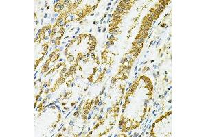 Immunohistochemistry (Paraffin-embedded Sections) (IHC (p)) image for anti-Major Histocompatibility Complex, Class II, DQ alpha 1 (HLA-DQA1) (AA 24-216) antibody (ABIN3023103)