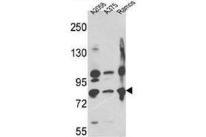 Western blot analysis of Neprilysin Antibody (C-term) in A2058,A375,Ramos cell line lysates (35ug/lane). (MME Antikörper  (C-Term))