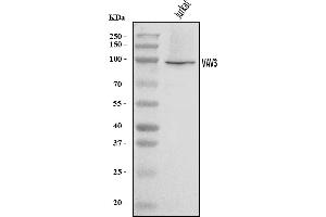 Western blot analysis of VAV3 using anti-VAV3 antibody (ABIN7601922).